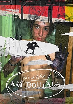 The Scars of Ali Boulala